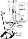 DISTAL LIMB