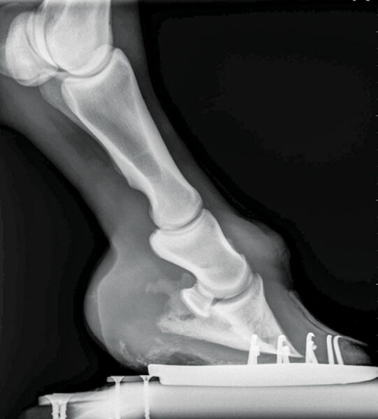 Club_foot_radiograph2.jpg