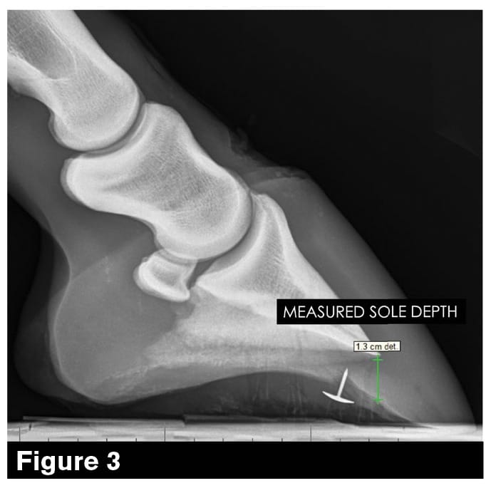 Sole thickness clearance